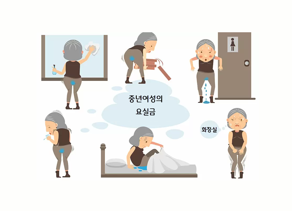 중년여성 요실금