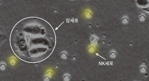 NK세포 낮은 활성도