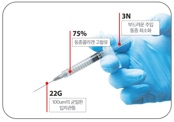 시지리알로 장점